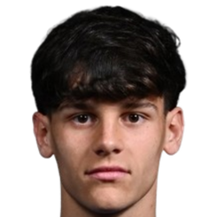 阿莱西奥·巴拉拉头像